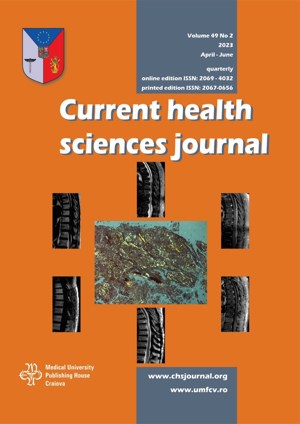 Current Health Sciences Journal, vol. 49 no. 2, 2023